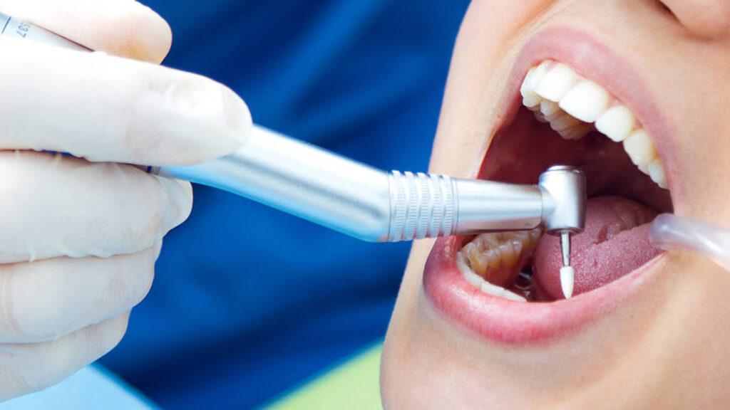 Endodoncia: evitando la extracción del diente natural